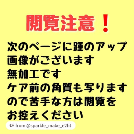 ナチュラルアクアジェル/Cure/ピーリングを使ったクチコミ(2枚目)