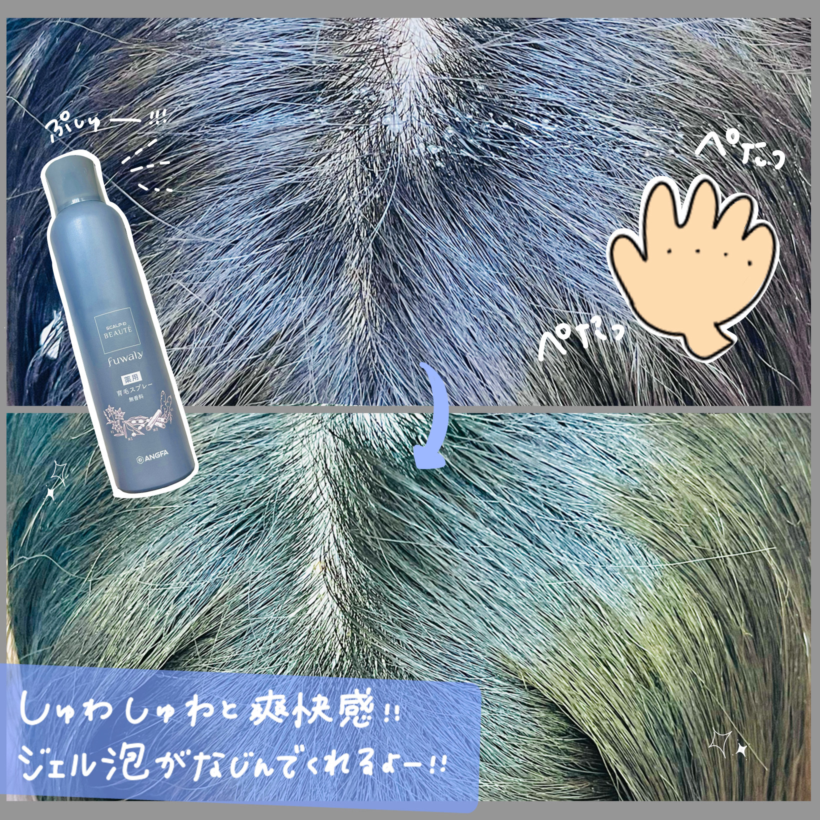 スカルプD ボーテ　フワリー　薬用育毛スプレー/アンファー(スカルプD)/頭皮ローションを使ったクチコミ（2枚目）