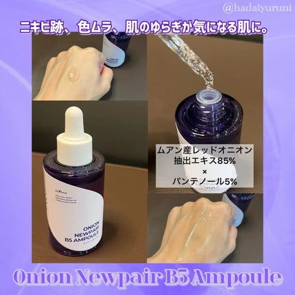 オニオンニューペア B5アンプル/Isntree/美容液を使ったクチコミ(2枚目)