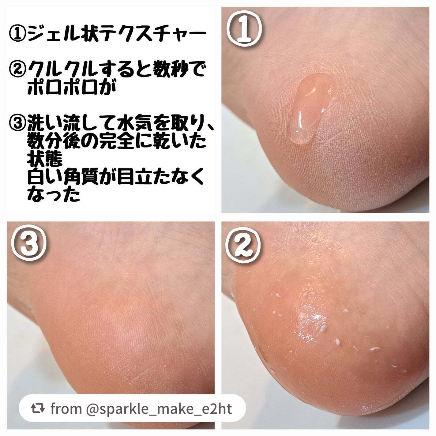 ナチュラルアクアジェル/Cure/ピーリングを使ったクチコミ(3枚目)