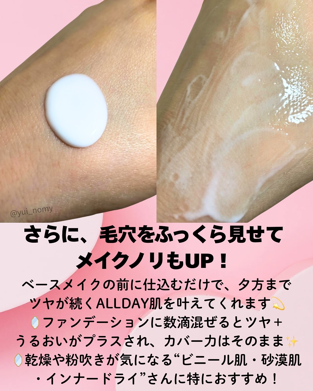 リードルS PDRN+ セラム/VT/美容液を使ったクチコミ（3枚目）