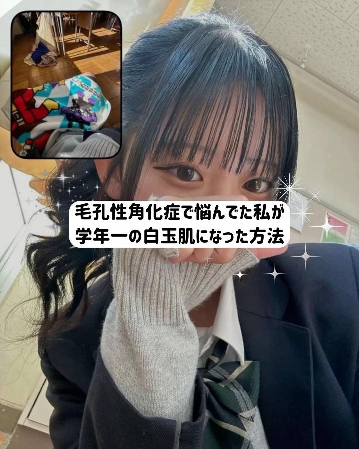 アネトス バランシング トリートメントクリーム/Anetos/フェイスクリームを使ったクチコミ(1枚目)