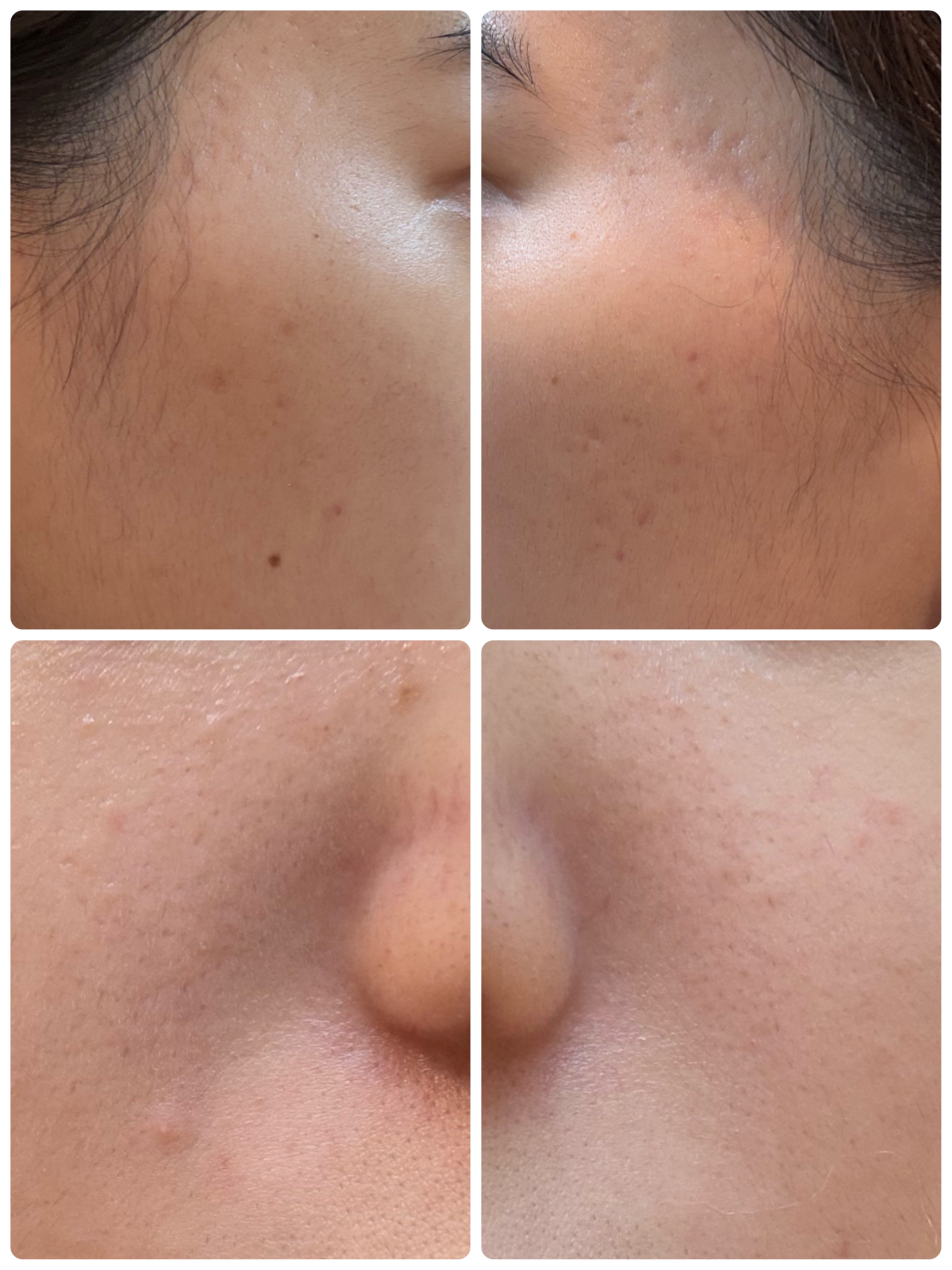 ブラックヘッドバームスクラブ/オブジェ/フェイスバームを使ったクチコミ（2枚目）