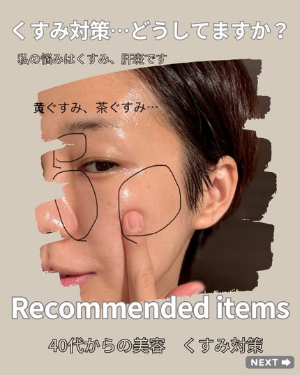 NAC 600mg/Now Foods/美容サプリメントを使ったクチコミ(1枚目)