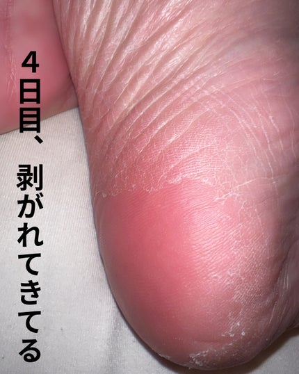 ましゅまろ素足/ピコモンテ/レッグ・フットケアを使ったクチコミ(5枚目)