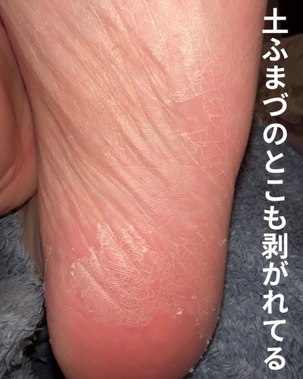 ましゅまろ素足/ピコモンテ/レッグ・フットケアを使ったクチコミ(6枚目)