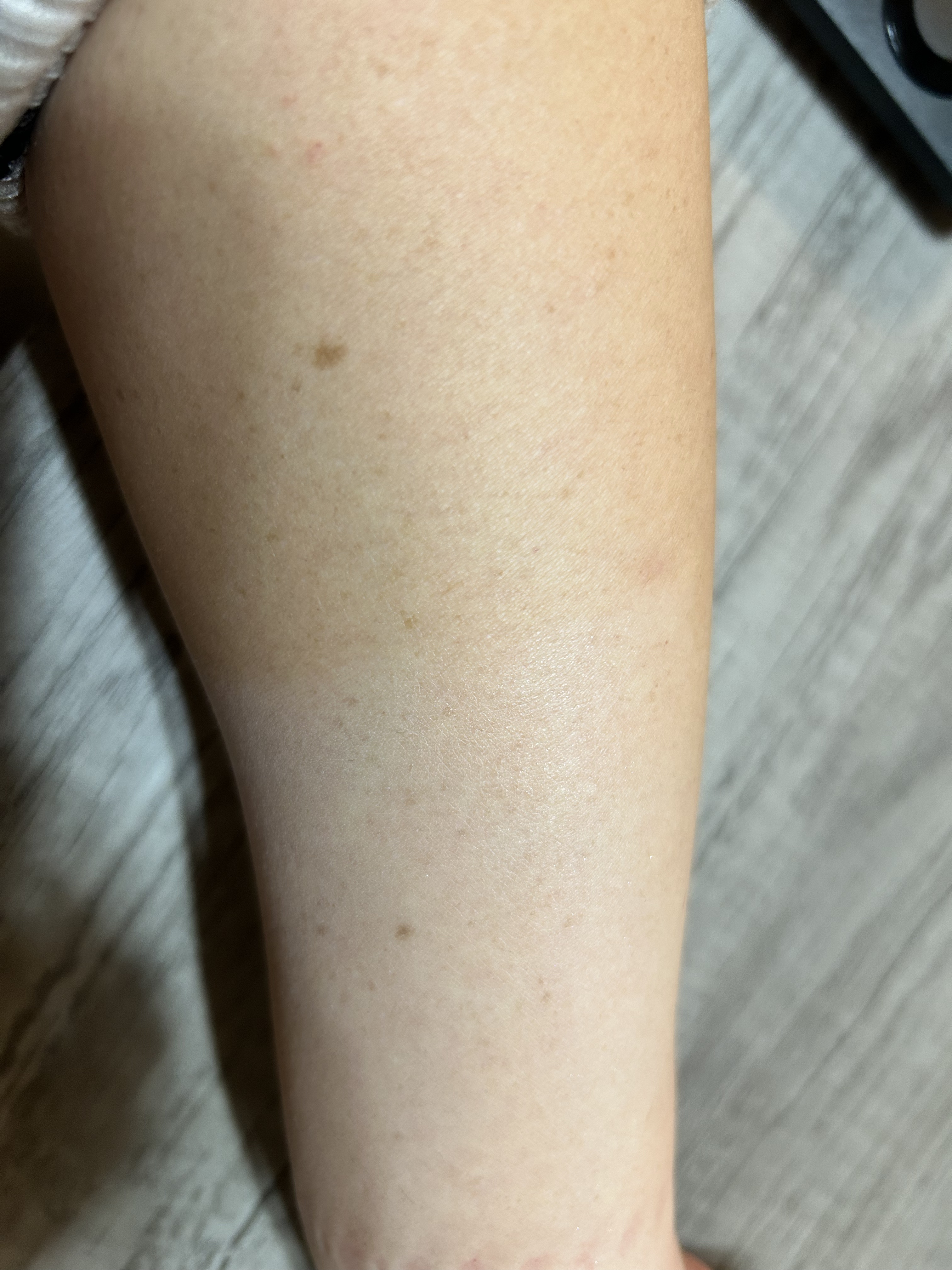 薬用ホワイトコンク ホワイトニングCC CII/ホワイトコンク/ボディクリームを使ったクチコミ（3枚目）