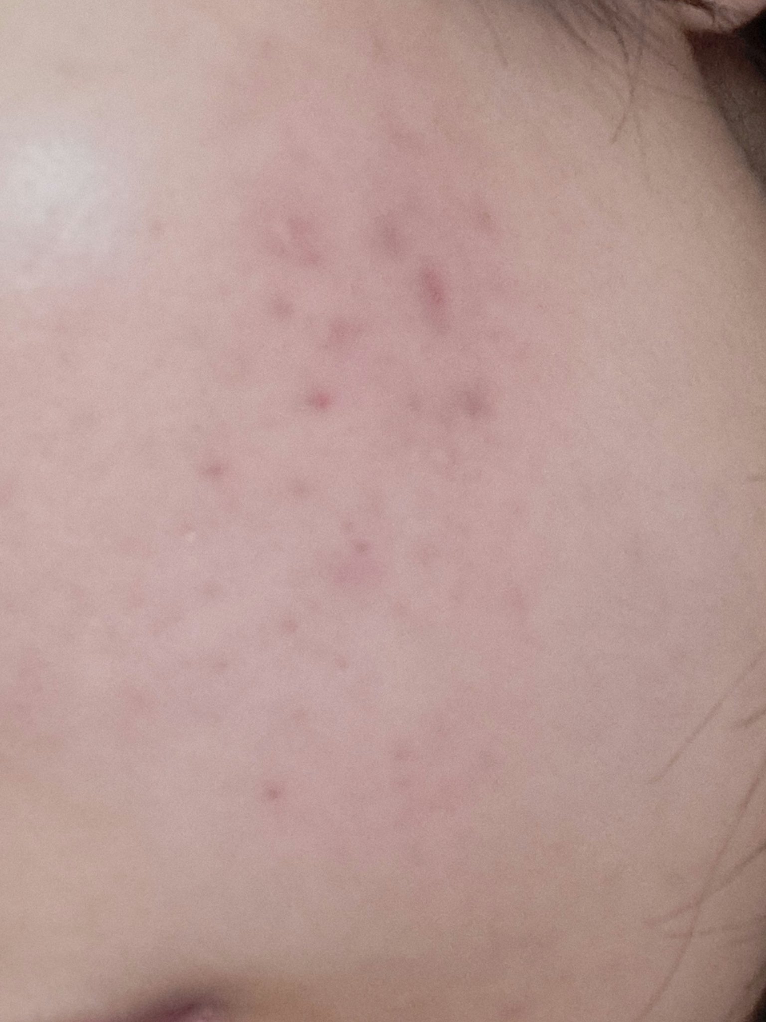 保湿浸透水バランシング  /松山油脂/化粧水を使ったクチコミ（2枚目）