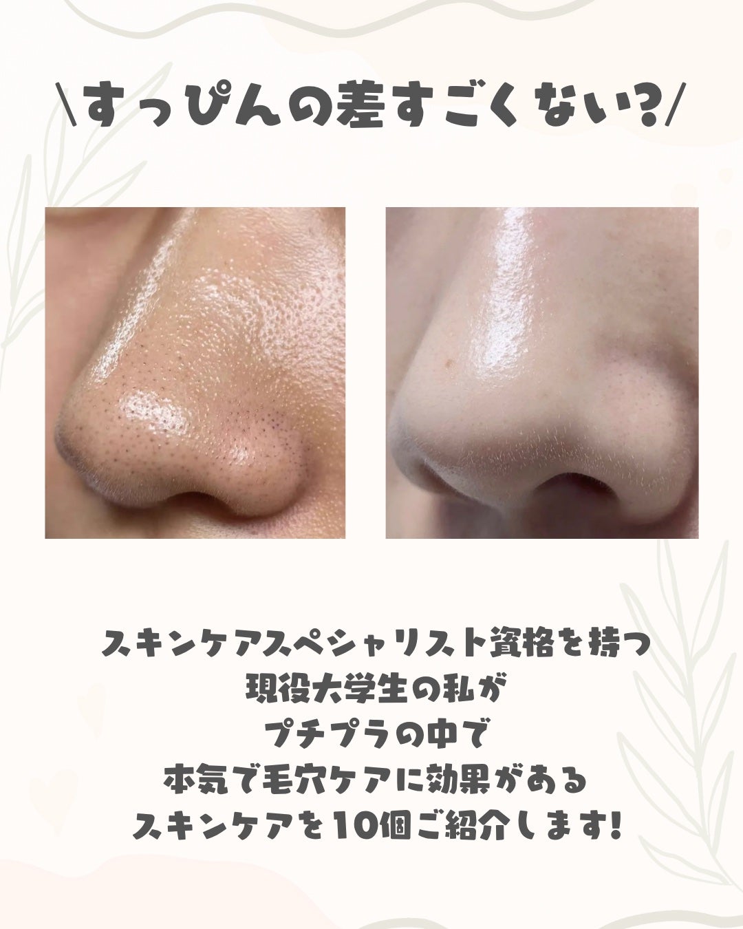 アネトス アクネケア トリートメント セラム/Anetos/美容液を使ったクチコミ(2枚目)
