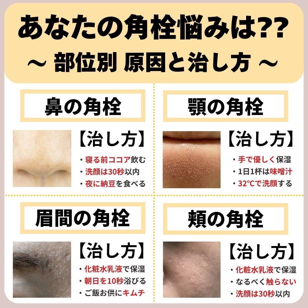 あなたの肌に合ったスキンケア💐コーくん先生 on LIPS 「【コレ見るだけ】悩み別原因と治し方リスト🎁..あなたのニキビ・..」(2枚目)