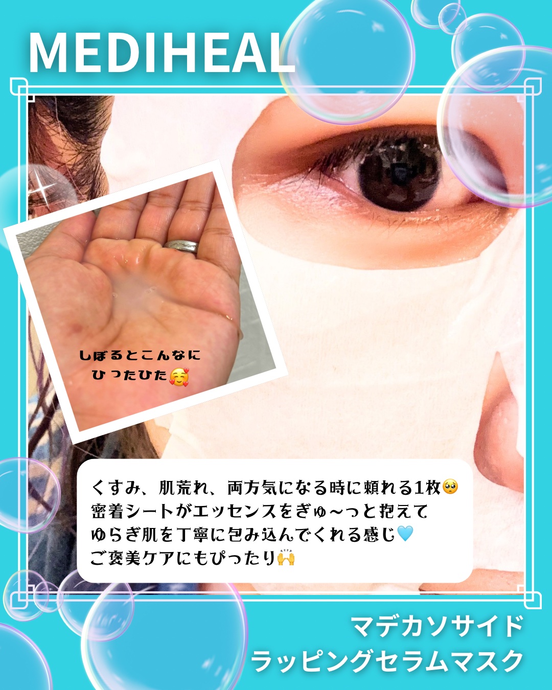 マデカッソシド ラッピングセラムマスク ブレミッシュリペア/MEDIHEAL/シートマスク・パックを使ったクチコミ（3枚目）