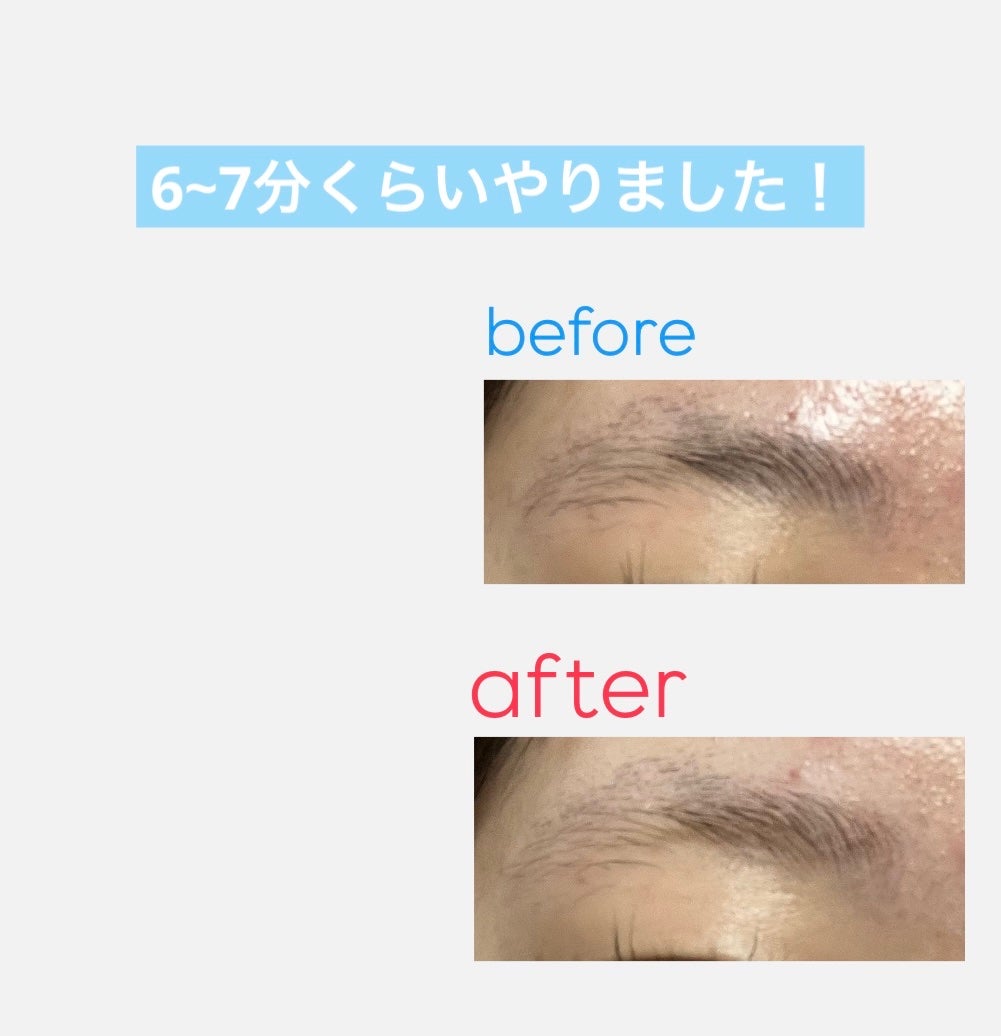 脱色クリーム 敏感肌用/エピラット/ムダ毛ケアを使ったクチコミ(2枚目)