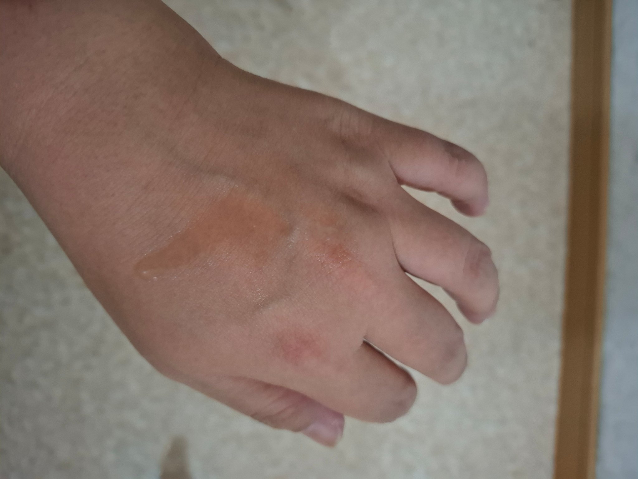 アデノバイタル スカルプ パワーショット/サブリミック/頭皮ローションを使ったクチコミ（3枚目）