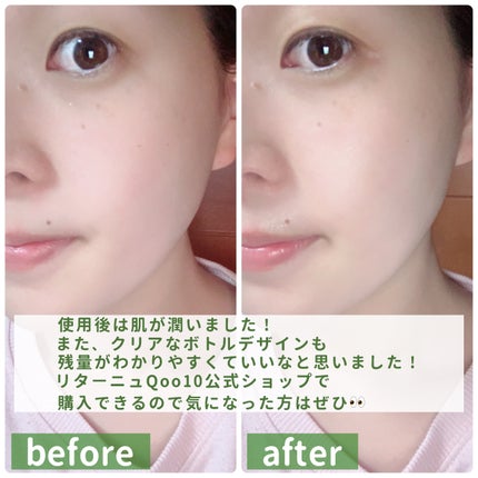 ポアシュータートナー/リターニュ/化粧水を使ったクチコミ(4枚目)