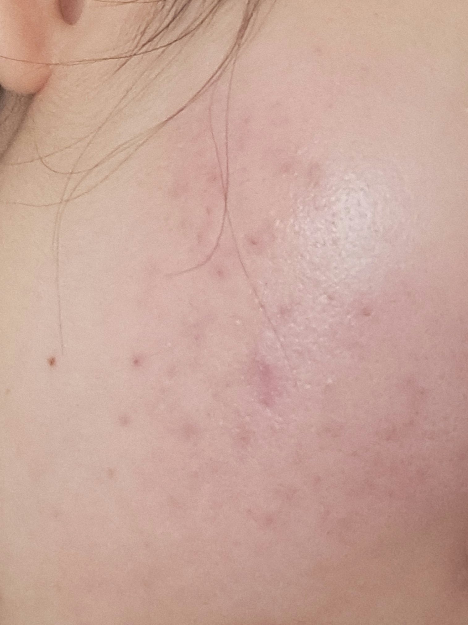 保湿浸透水バランシング  /松山油脂/化粧水を使ったクチコミ（1枚目）