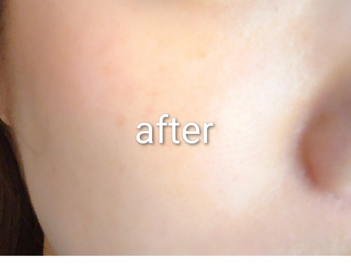 シカダーマヒットセラム10/KATAN/美容液を使ったクチコミ（2枚目）