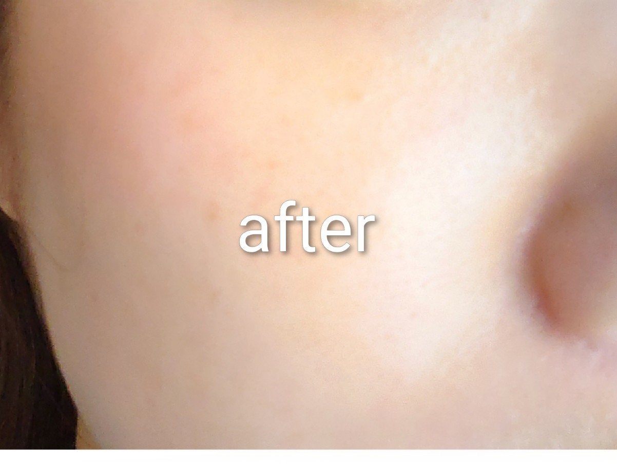 シカダーマヒットセラム10/KATAN/美容液を使ったクチコミ(2枚目)