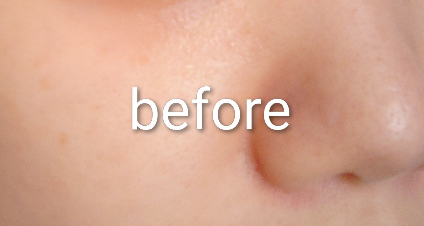 シカダーマヒットセラム10/KATAN/美容液を使ったクチコミ（1枚目）