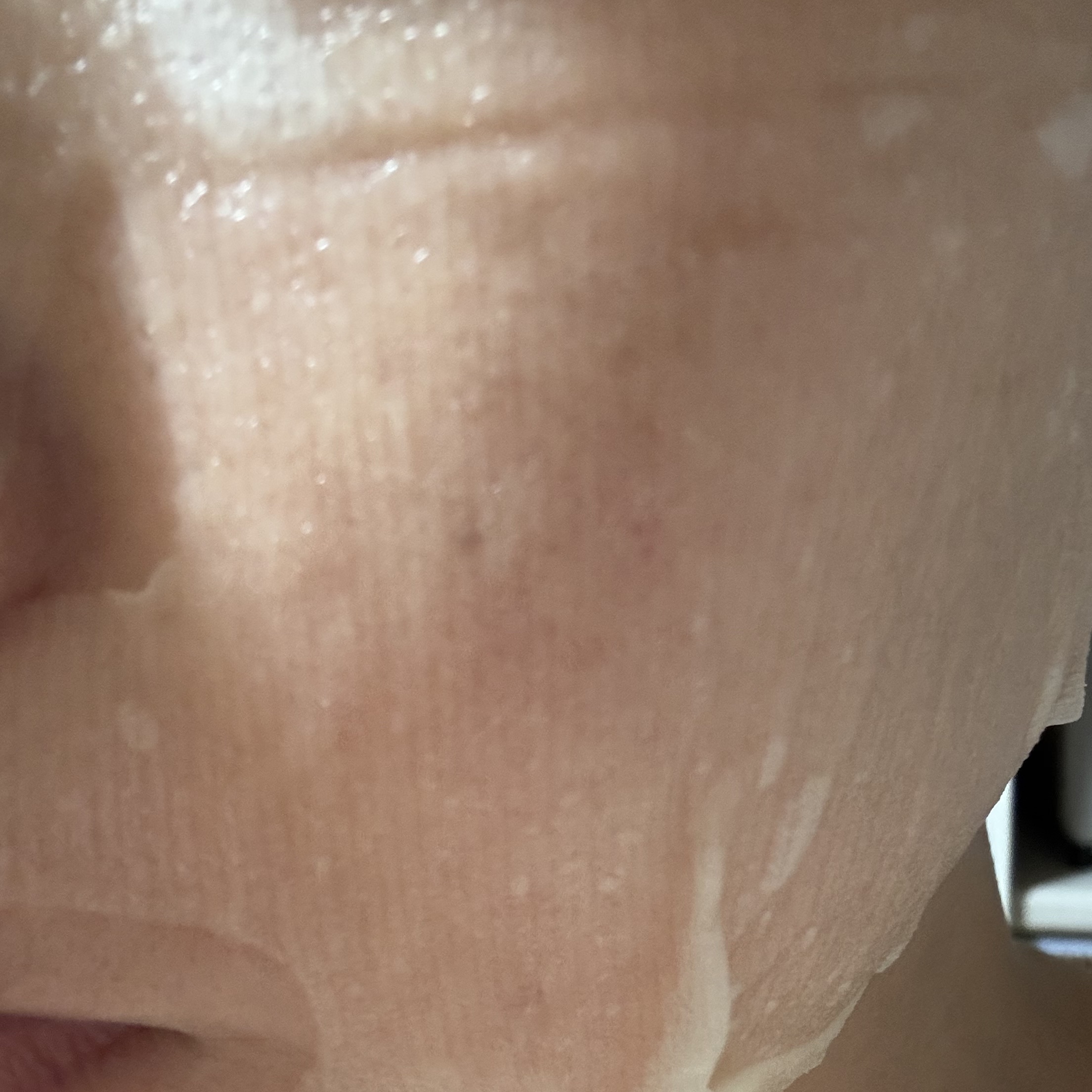 VC+3 Bright Banana Peel Mask/LIALUSTER/シートマスク・パックを使ったクチコミ（3枚目）