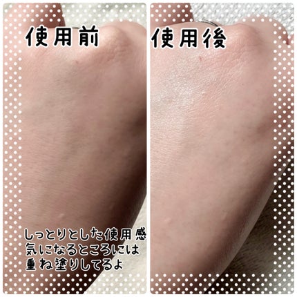 360度ショットPDRNアクティブセラム/センテリアン24/美容液を使ったクチコミ(3枚目)