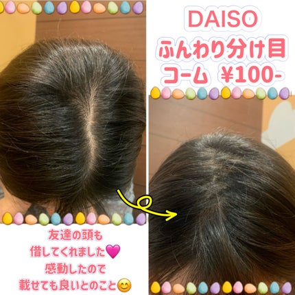 DAISO ふんわり分け目コームのクチコミ「🌸ダイソー🌸
🌸ふんわり分け目コーム🌸
簡単に分け目が無くなります🩷
数十年間…頭にずーっ.....」(2枚目)