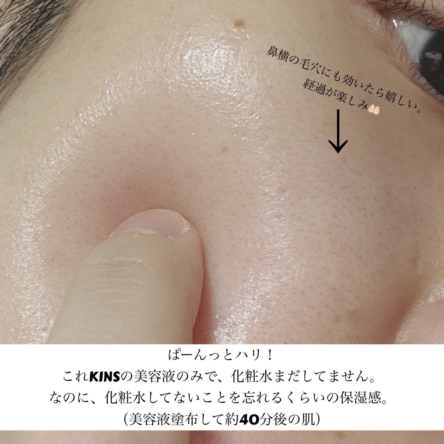 BOOSTER MOIST/KINS/ブースター・導入液を使ったクチコミ（3枚目）