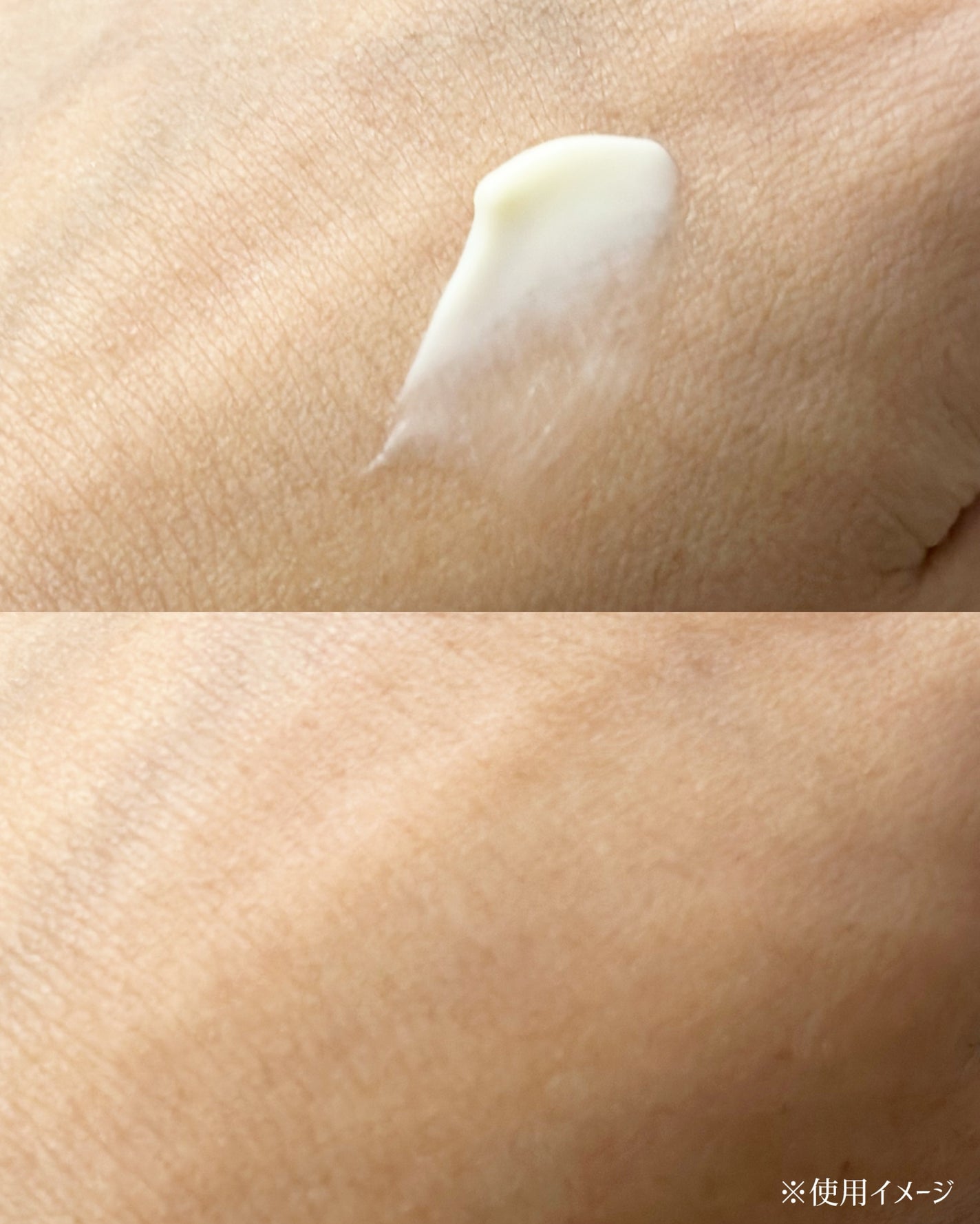 ダーマセプトRX VAセラム/ダーマセプトRX/美容液を使ったクチコミ(3枚目)