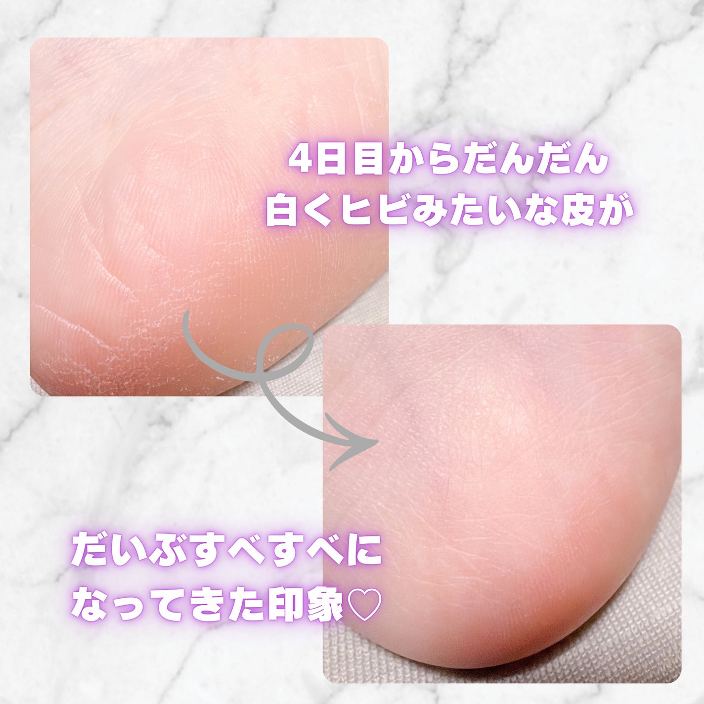 ましゅまろ素足/ピコモンテ/レッグ・フットケアを使ったクチコミ(5枚目)