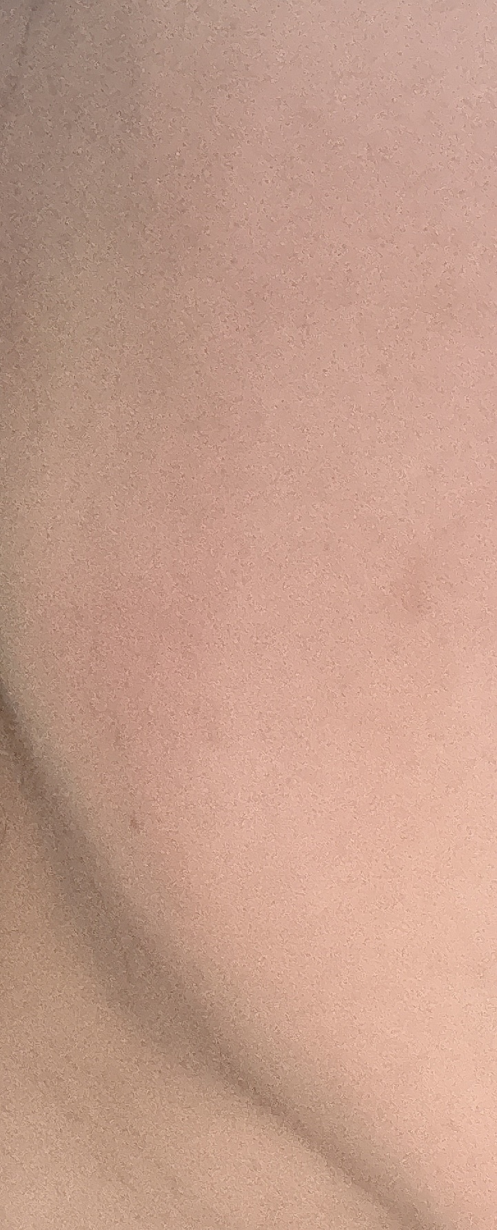 super power mask/AROCELL/シートマスク・パックを使ったクチコミ（2枚目）