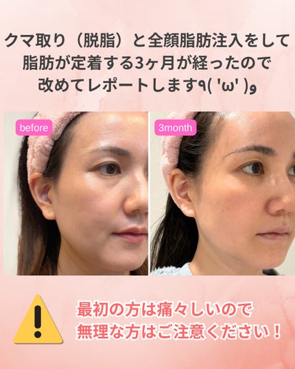 を使ったクチコミ(2枚目)