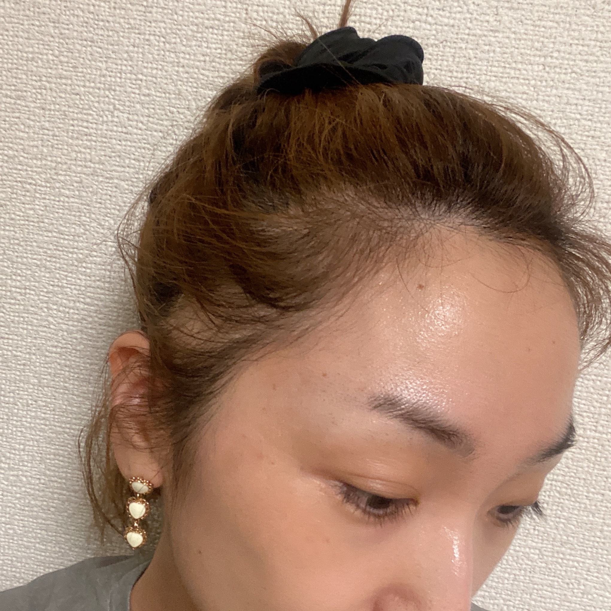 #若気の至り
#エクステハゲ

治らないし、
今は隠さない。
生き様だから(笑)

でもたまには隠すけどね
😅

ハゲでも理由が
あるから
優しい目で
見て欲しいな❤️

あくまでも私のエクステの扱いか
悪かっただけ。

美容院、美容師さ