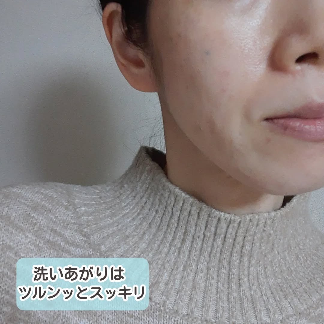 DETクリア ブライト＆ピール ピーリングジェリー＜無香料タイプ＞/Detclear/ピーリングを使ったクチコミ（3枚目）