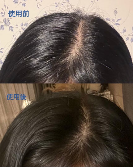 B.scalp ヘッドスクラブ HUG MYSELF/TBC/ヘッドスクラブを使ったクチコミ(5枚目)