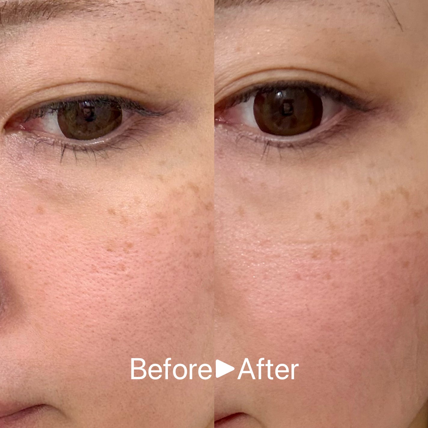 VC+3 Bright Banana Peel Mask/LIALUSTER/シートマスク・パックを使ったクチコミ(3枚目)