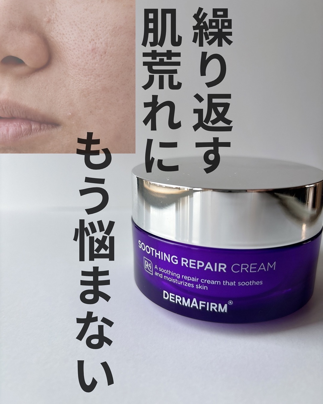 [R4] SOOTHING REPAIR CREAM /ダーマファーム/フェイスクリームを使ったクチコミ（1枚目）