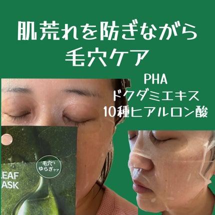 ドクダミポアマスク/ISOI/シートマスク・パックを使ったクチコミ(2枚目)