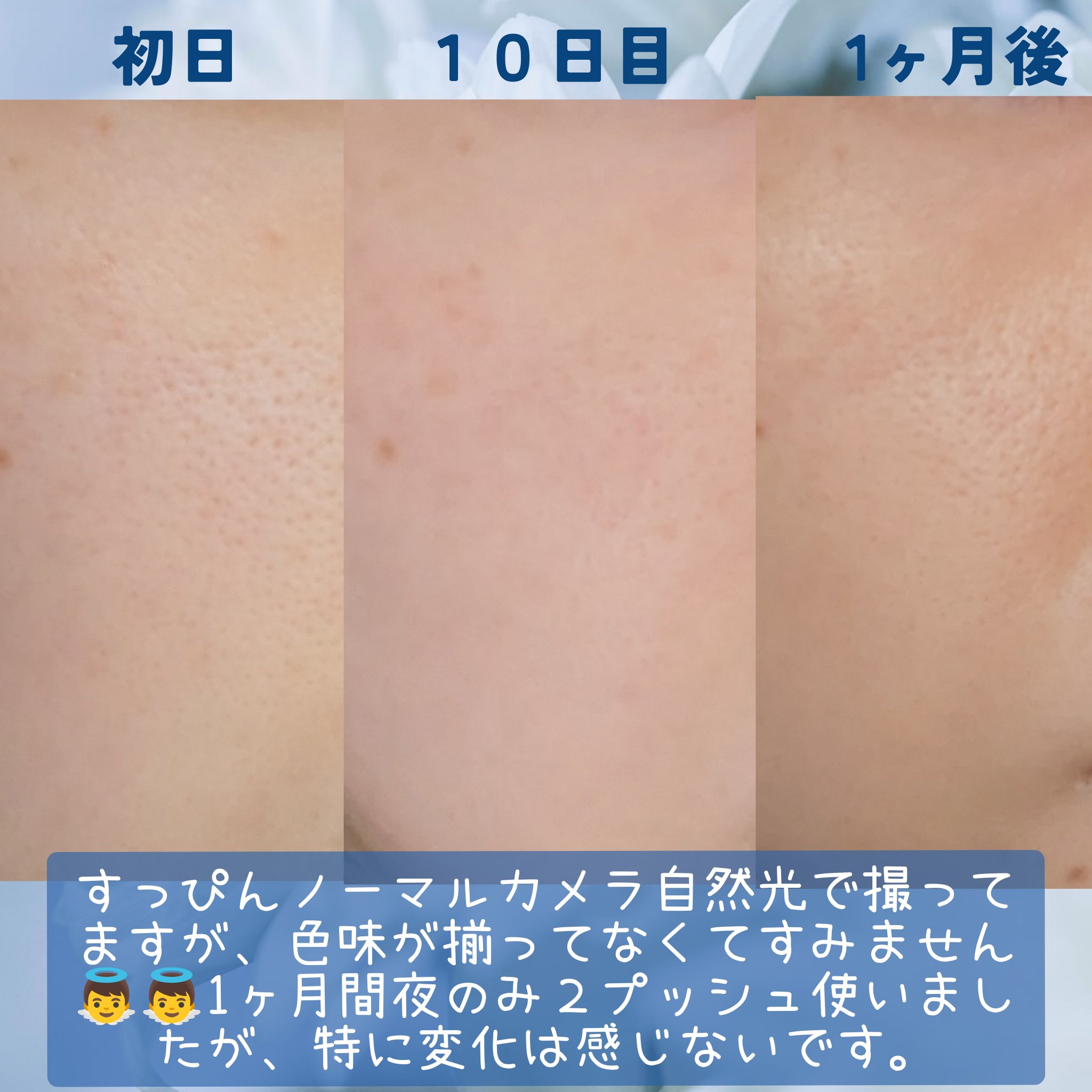 ジェニフィック アルティメ セラム/LANCOME/美容液を使ったクチコミ（2枚目）