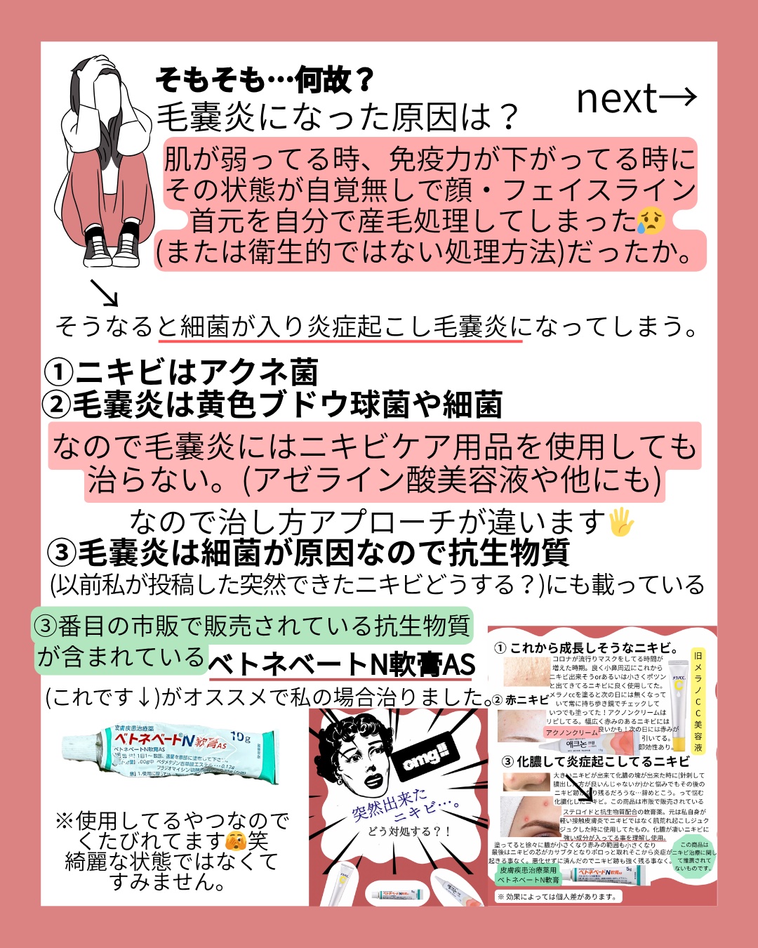 ベトネベートN軟膏AS(医薬品)/第一三共ヘルスケア/その他を使ったクチコミ（2枚目）