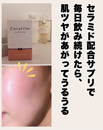 Cerafilm/Vall/美容サプリメントを使ったクチコミ(3枚目)