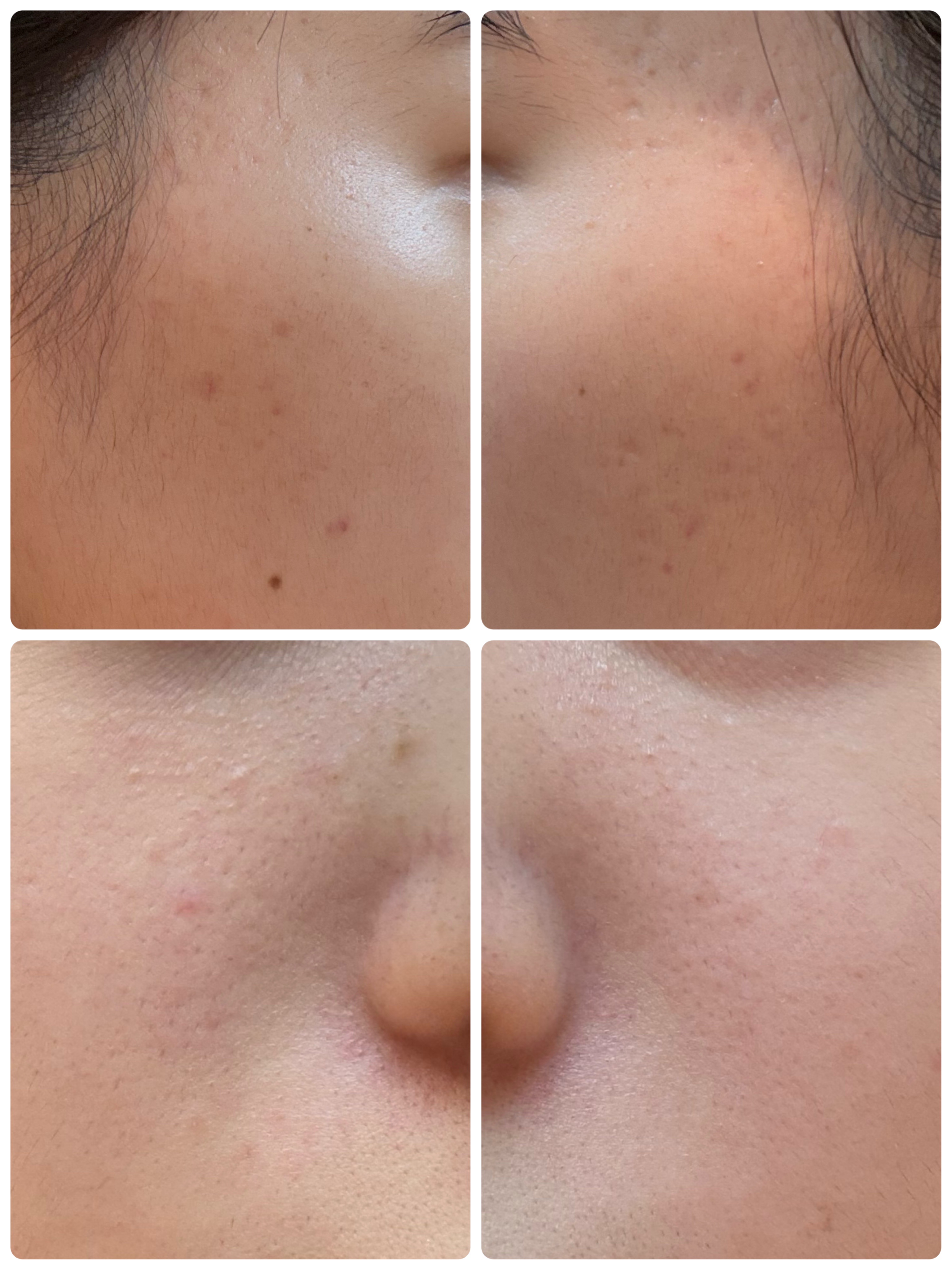 AGE-R ブースタープロ/MEDICUBE/美顔器・マッサージを使ったクチコミ（2枚目）