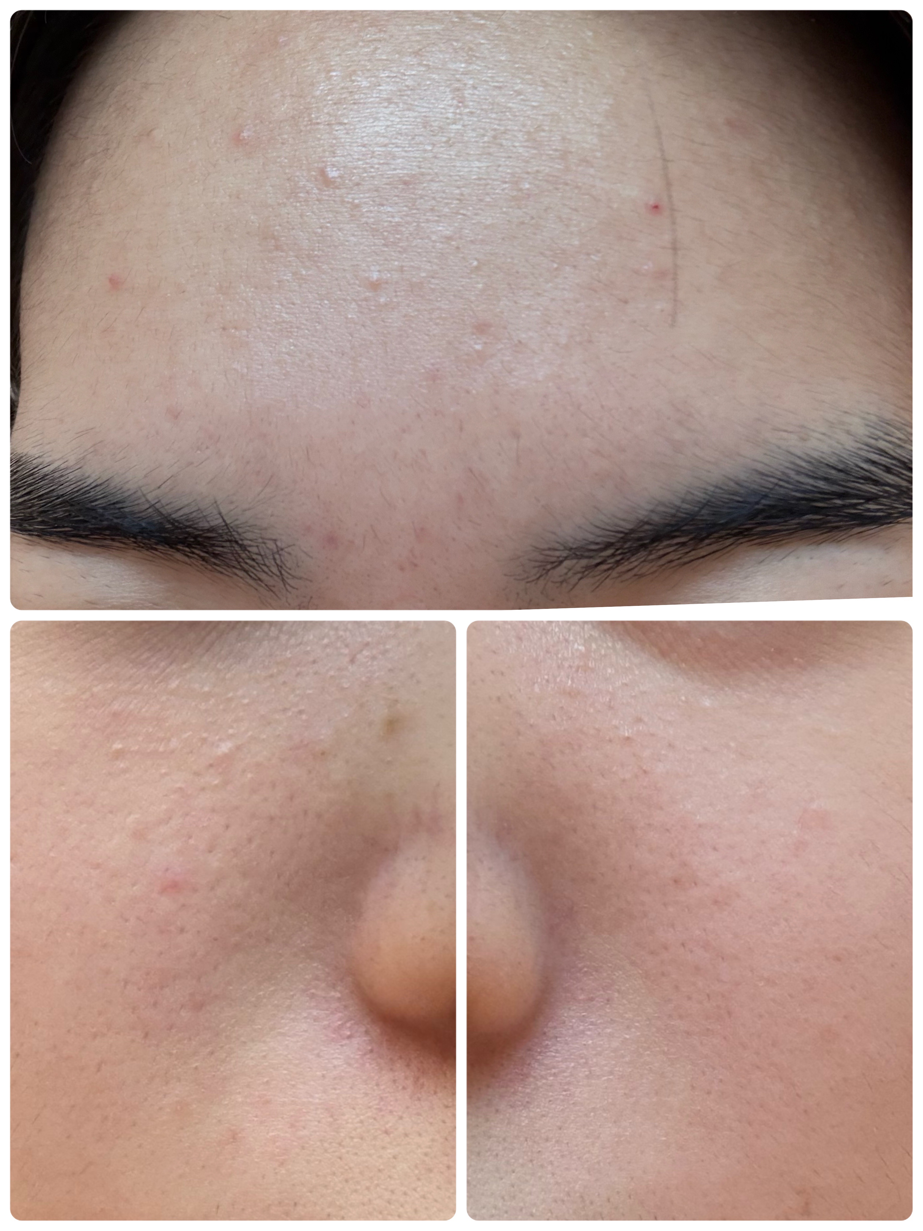 AGE-R ブースタープロ/MEDICUBE/美顔器・マッサージを使ったクチコミ（3枚目）