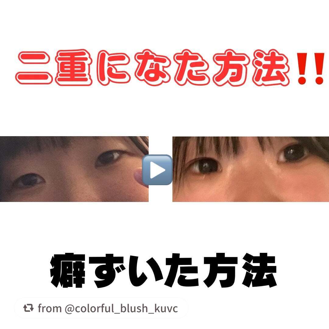 ルドゥーブル/ルドゥーブル/二重まぶた用アイテムを使ったクチコミ(1枚目)