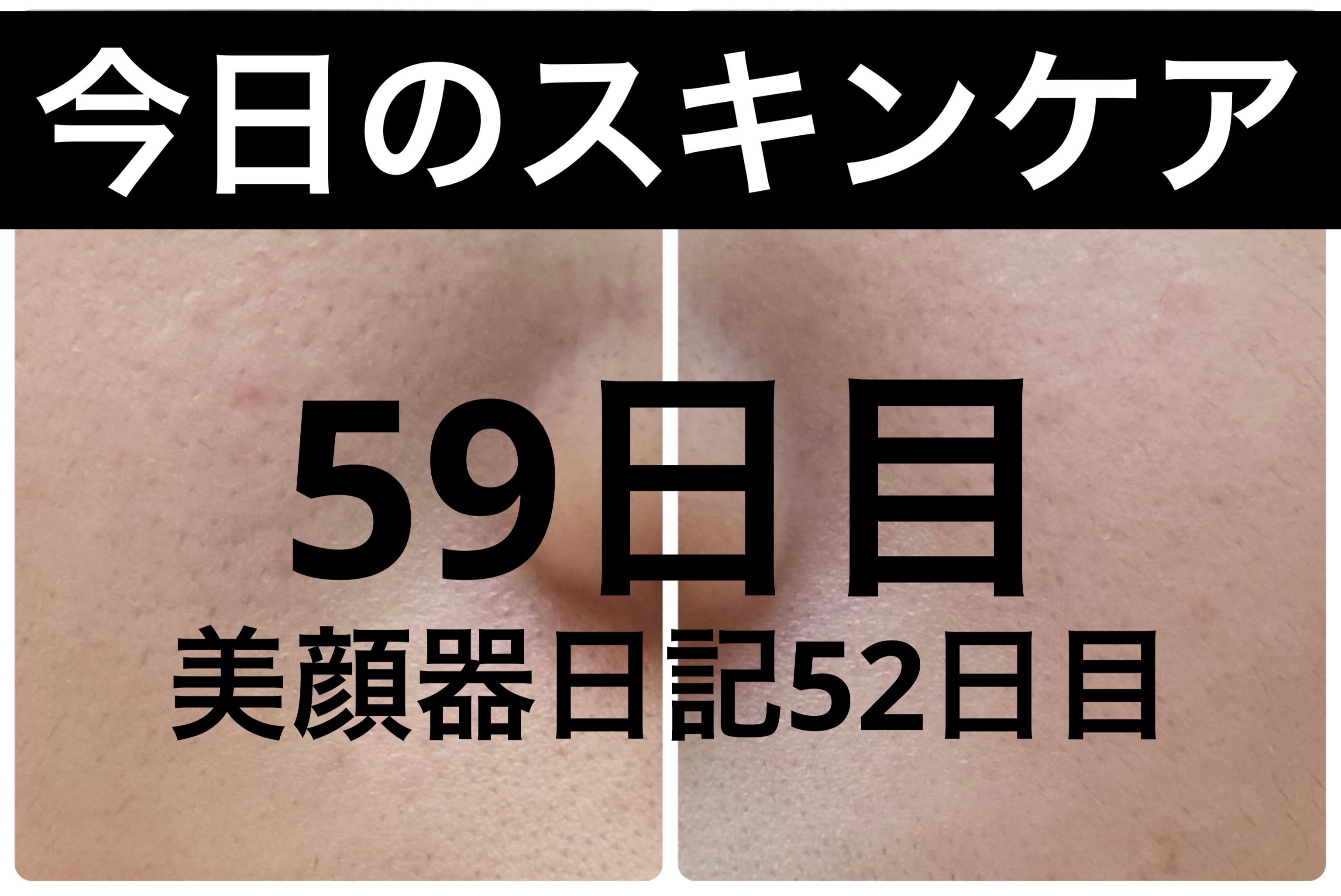 AGE-R ブースタープロ/MEDICUBE/美顔器・マッサージを使ったクチコミ（1枚目）