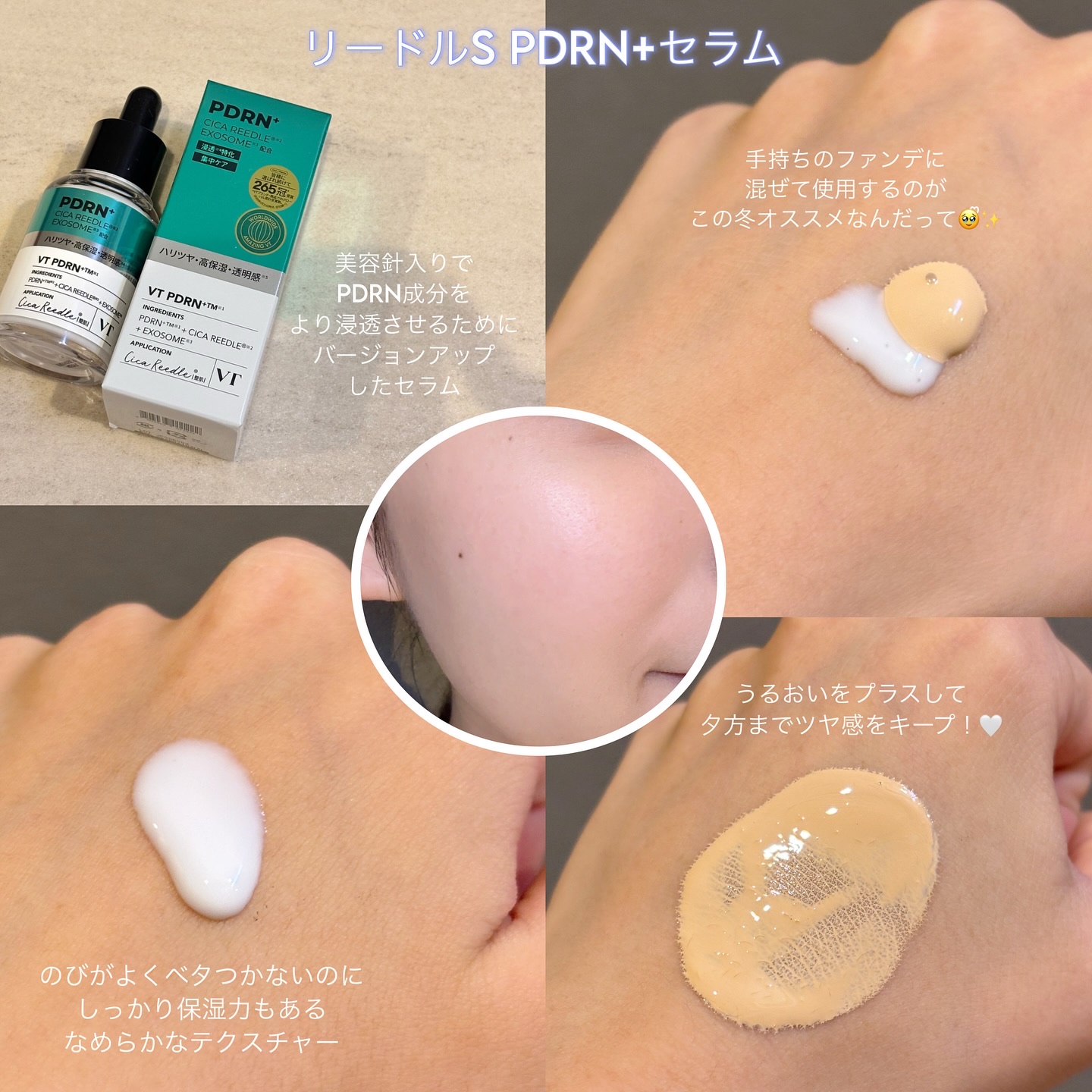 リードルS PDRN+ セラム/VT/美容液を使ったクチコミ（2枚目）