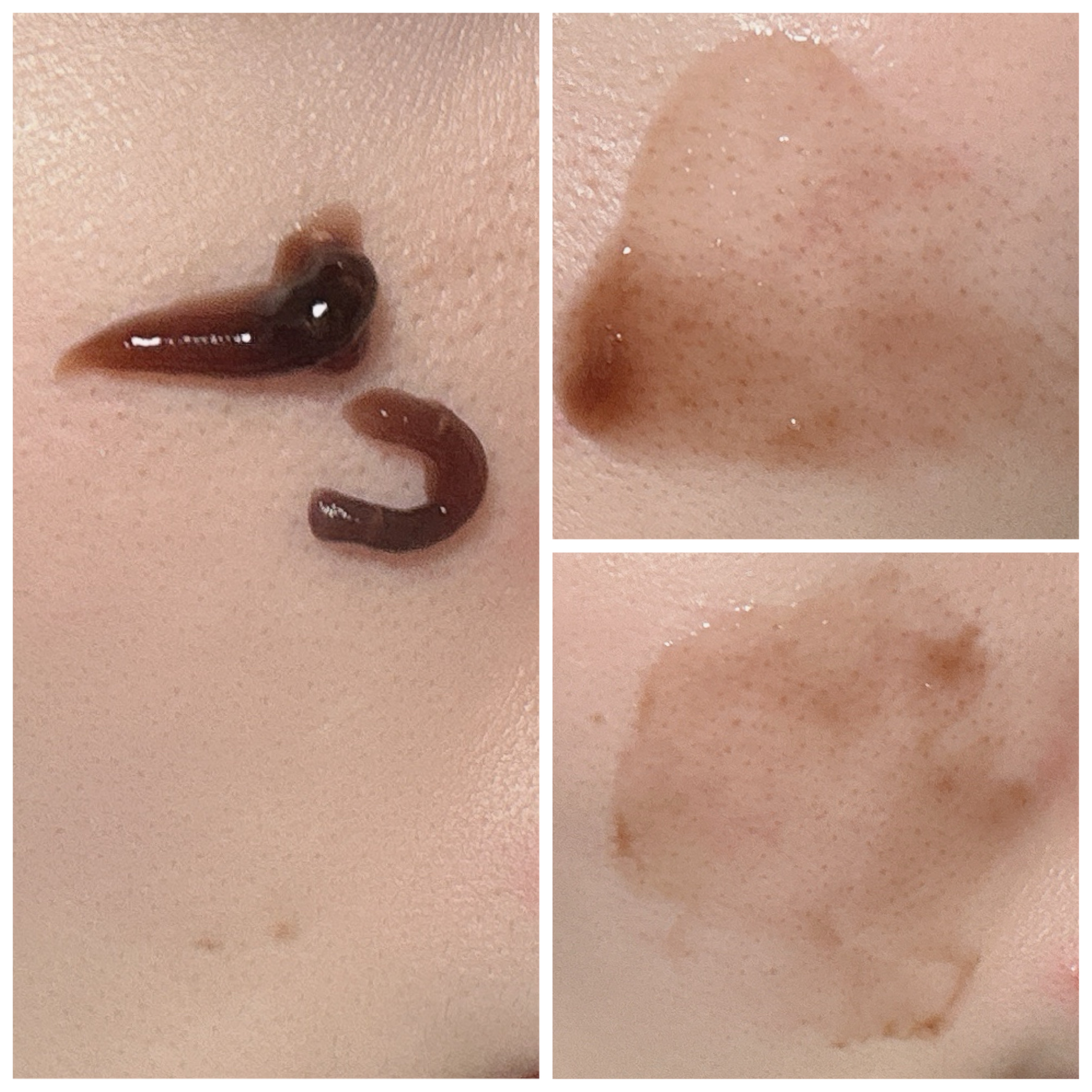 レッドブースター リードルショット100/VT/ブースター・導入液を使ったクチコミ（2枚目）