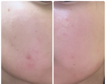 ぽむ on LIPS 「1枚目 2025.10.23エピデュオ 771日目2枚目 20..」(2枚目)