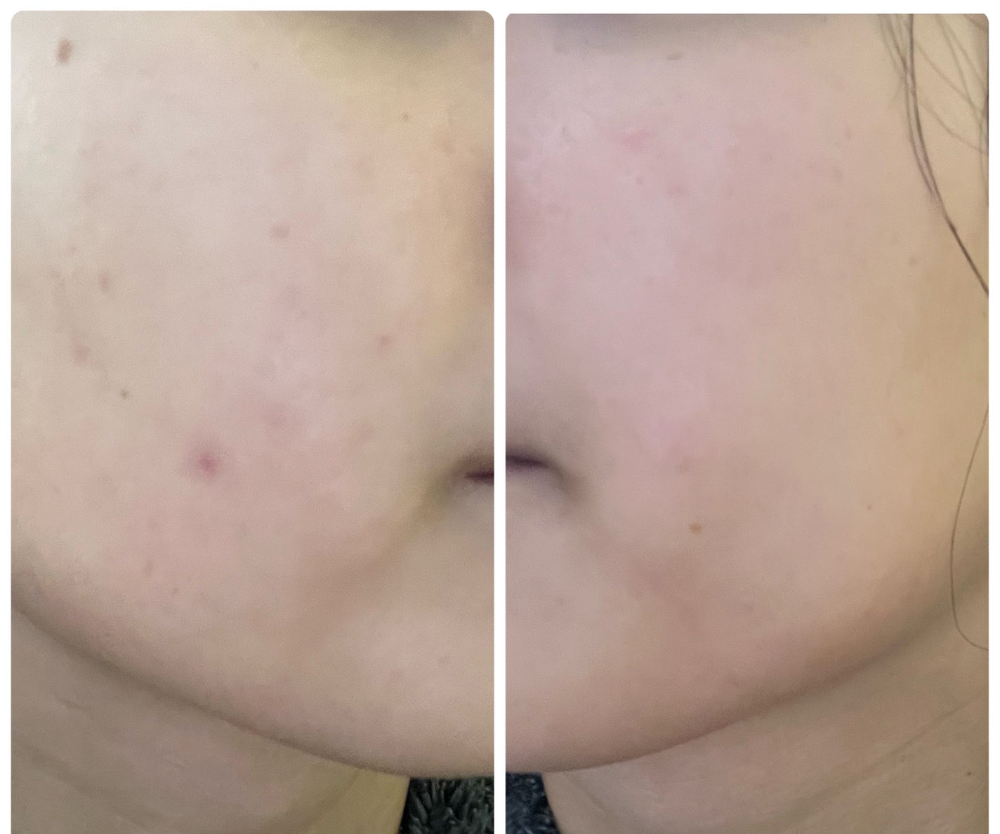 ぽむ on LIPS 「1枚目 2025.10.23エピデュオ 771日目2枚目 20..」(1枚目)