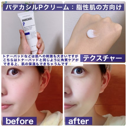 バデカシルDクリーム/23years old/フェイスクリームを使ったクチコミ(3枚目)