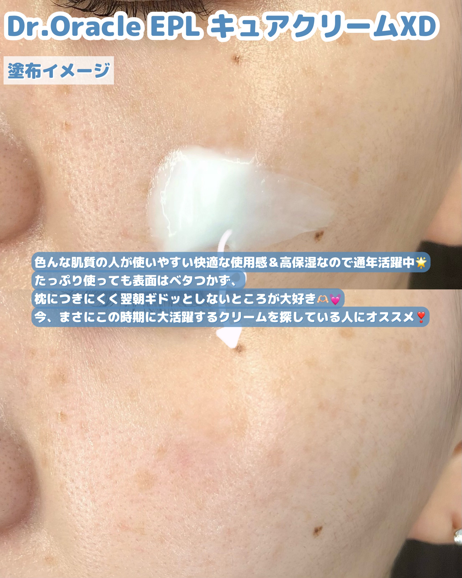 EPL キュアクリームXD/Dr.Oracle/フェイスクリームを使ったクチコミ（3枚目）