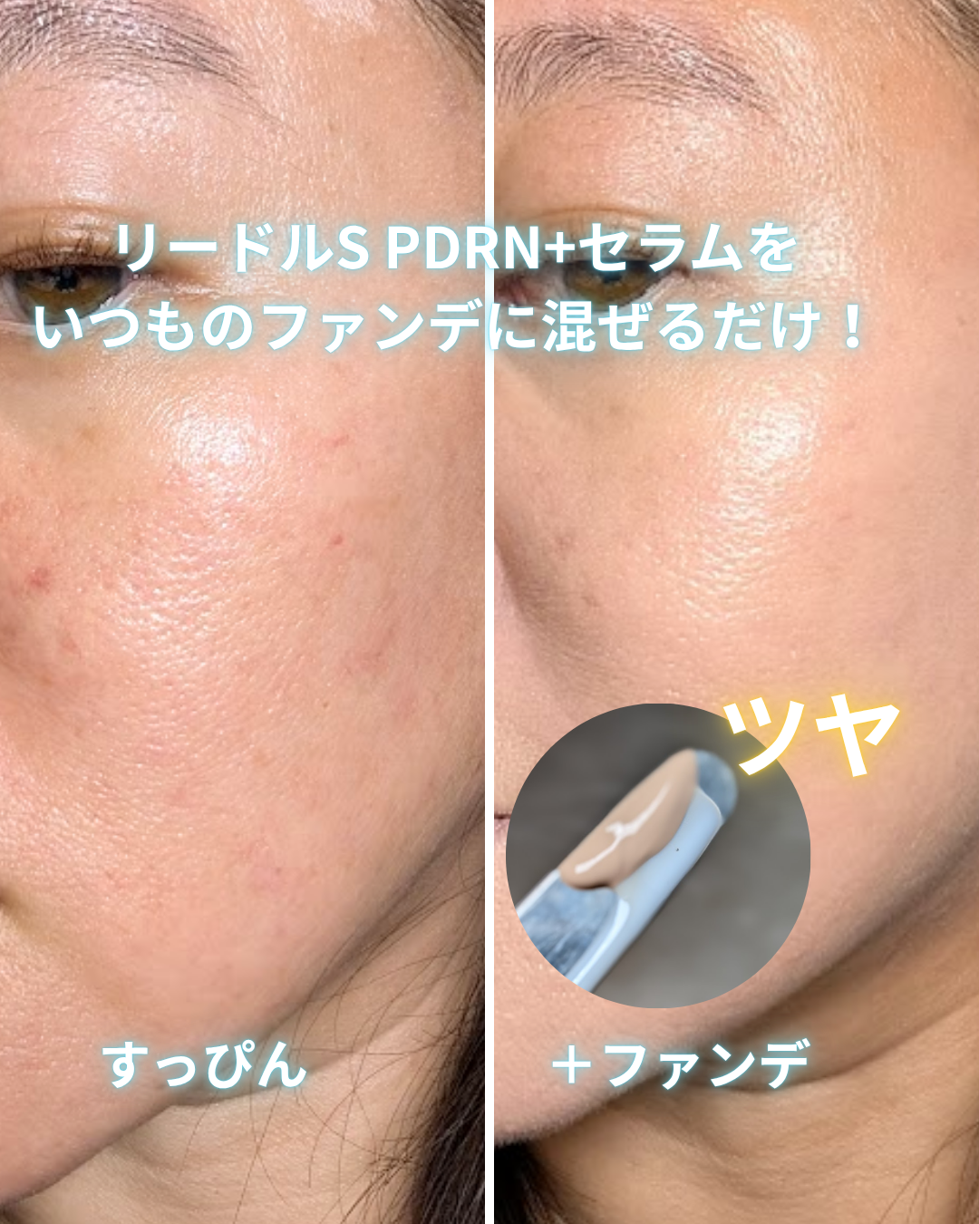 リードルS PDRN+ セラム/VT/美容液を使ったクチコミ（2枚目）